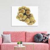 腫瘍の顕微鏡的見解5 キャンバスプリント (インサイチュ (リビング))