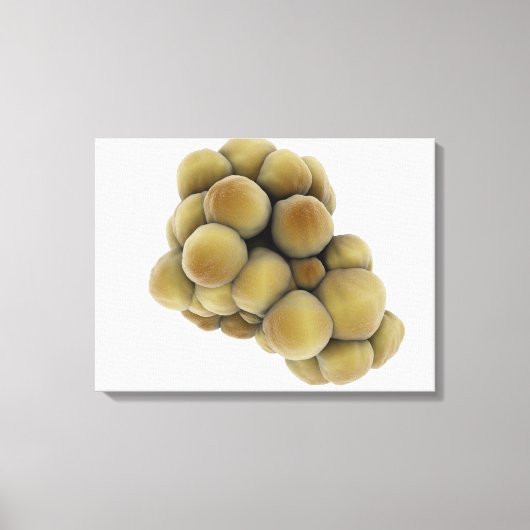 腫瘍の顕微鏡的見解5 キャンバスプリント (正面)