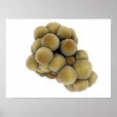 腫瘍の顕微鏡的見解5 ポスター (正面)