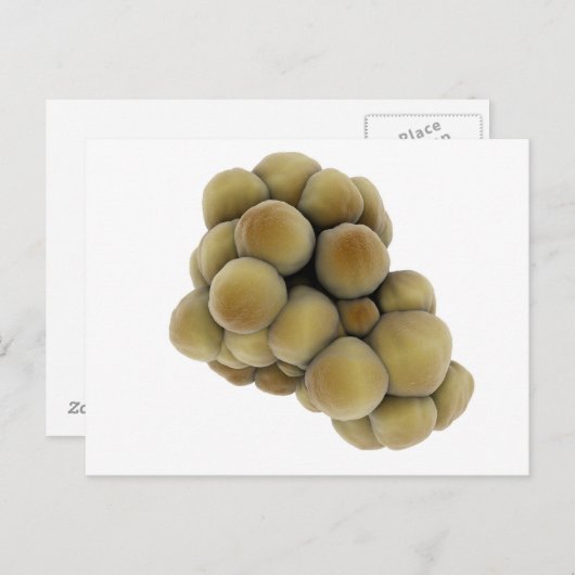 腫瘍の顕微鏡的見解5 ポストカード (正面/裏面)