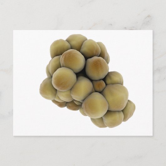 腫瘍の顕微鏡的見解5 ポストカード (正面)