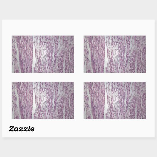 腫瘍内浸潤を伴うヒト子宮組織の細胞 長方形シール (シート)