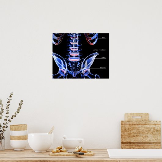 腰の骨 ポスター (キッチン)