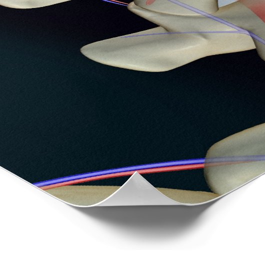 腰椎の血液供給 ポスター (角)