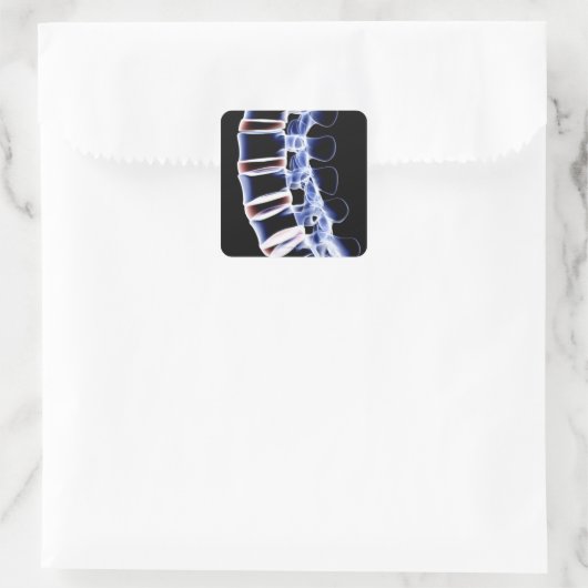 腰椎2 スクエアシール (バッグ)