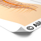 腰硬膜外注射、ラベル付き図。 ポスター (角)