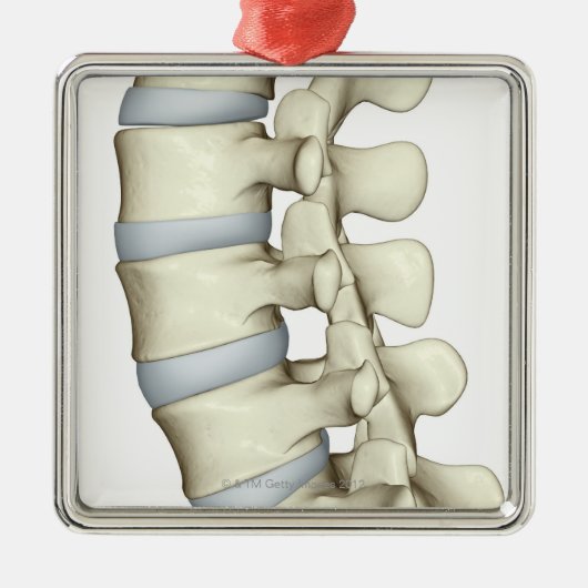 腰神経椎骨 メタルオーナメント (正面)