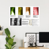 腰部スペインの脊髄変性ポスター ポスター (ホームオフィス)