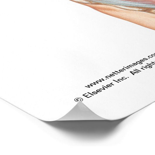 腹筋ポスター ポスター (角)