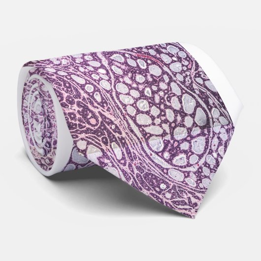 腺様嚢胞性涙腺 ネクタイ (ロール)