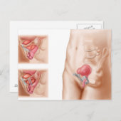 膀胱懸濁法の解剖学 ポストカード (正面/裏面)