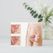 膀胱懸濁法の解剖学 ポストカード (スタンド正面)