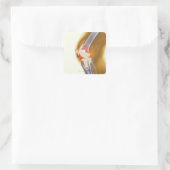 膝の交換。全膝の色のX線 スクエアシール (バッグ)