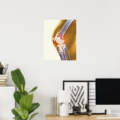 膝の交換。全膝の色のX線 ポスター (ホームオフィス)