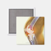 膝の交換。全膝の色のX線 マグネット (正面/裏面)