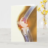 膝の取り替え。 総膝の着色されたX線 カード (黄色い花)