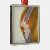 膝の取り替え。 総膝の着色されたX線 メタルオーナメント (右)