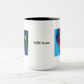 膝のMRI マグカップ (中央)
