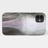 膝のX線IPHONEカバー Case-Mate iPhoneケース (裏面(横))