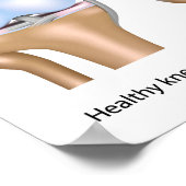 膝関節変形性関節症ポスター ポスター (角)