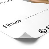 膝関節解剖図。 ポスター (角)