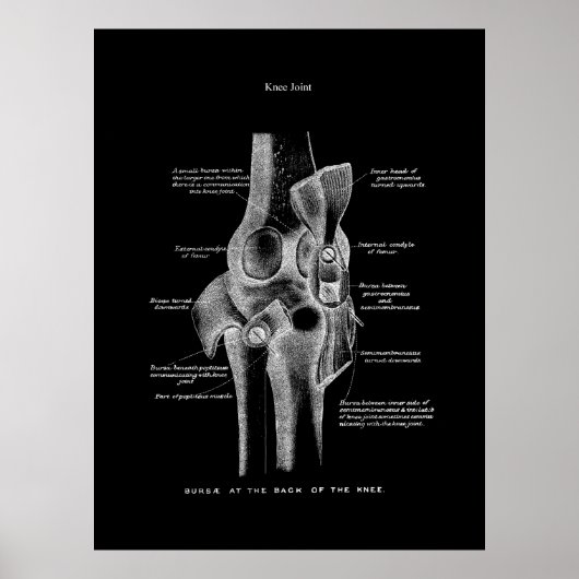 膝関節解剖学 ポスター (正面)