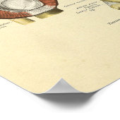 膝靱帯関節解剖骨プリント ポスター (角)