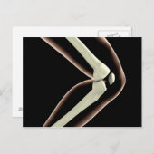 膝1のX線画像 ポストカード (正面/裏面)