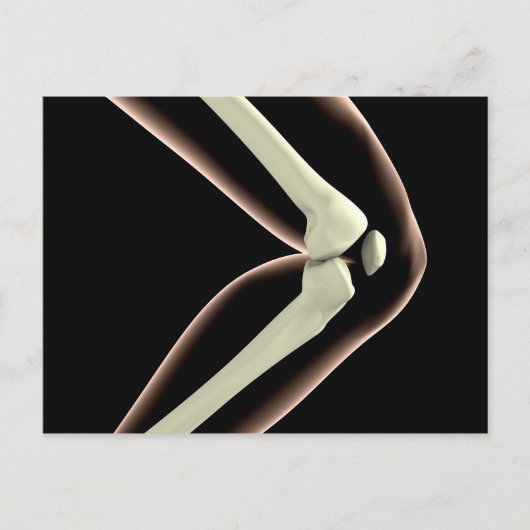 膝1のX線画像 ポストカード (正面)