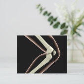 膝1のX線画像 ポストカード (スタンド正面)