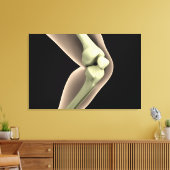 膝2のX線画像 キャンバスプリント (インサイチュ (リビング))