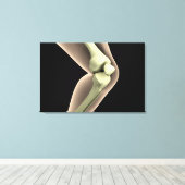 膝2のX線画像 キャンバスプリント (インサイチュ (ウッドフロア))