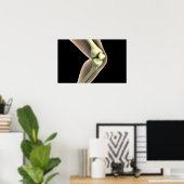 膝2のX線画像 ポスター (ホームオフィス)