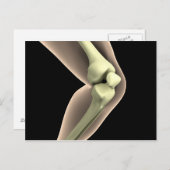 膝2のX線画像 ポストカード (正面/裏面)