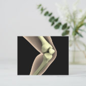 膝2のX線画像 ポストカード (スタンド正面)