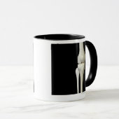 膝4の骨 マグカップ (正面右)