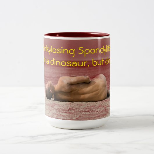 膠着のSpondylitis恐竜のマグではなく ツートーンマグカップ (中央)