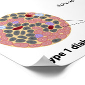 膵島糖尿病ポスター ポスター (角)