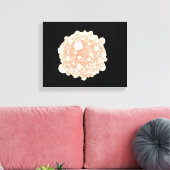 膵臓がん細胞の顕微鏡的見解 キャンバスプリント (インサイチュ (リビング))