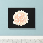 膵臓がん細胞の顕微鏡的見解 キャンバスプリント (インサイチュ (ウッドフロア))