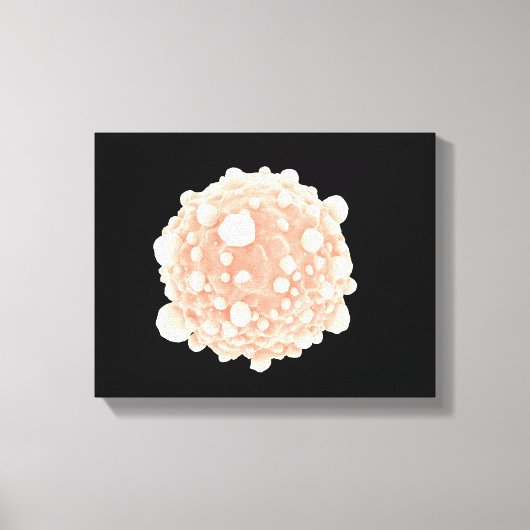 膵臓がん細胞の顕微鏡的見解 キャンバスプリント (正面)