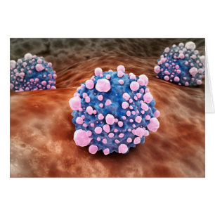膵臓癌の細胞2のMicroscipicの眺め