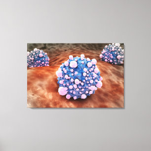 膵臓癌の細胞2のMicroscipicの眺め キャンバスプリント