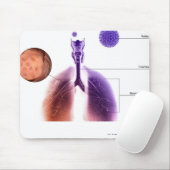 花粉からの喘息の発作のイラストレーション マウスパッド (マウス)