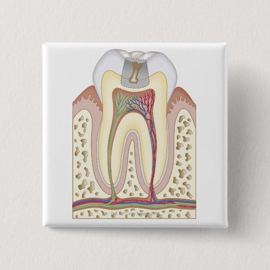 虫歯イラストレーション 缶バッジ (正面)