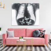 蝶の胃内のX線 キャンバスプリント (インサイチュ (リビング))