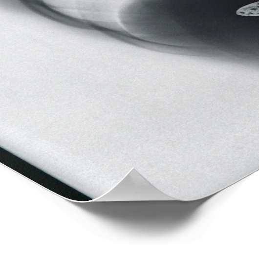 蝶の胃内のX線 ポスター (角)