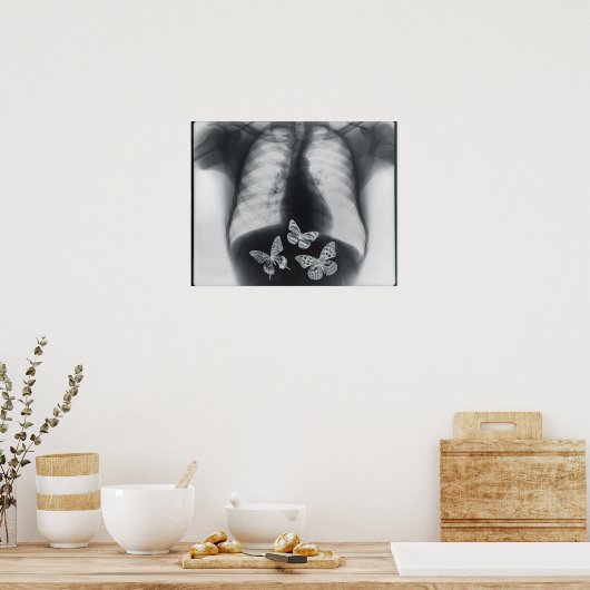 蝶の胃内のX線 ポスター (キッチン)