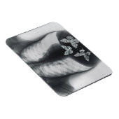 蝶の胃内のX線 マグネット (右側)