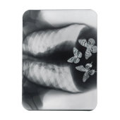 蝶の胃内のX線 マグネット (縦)